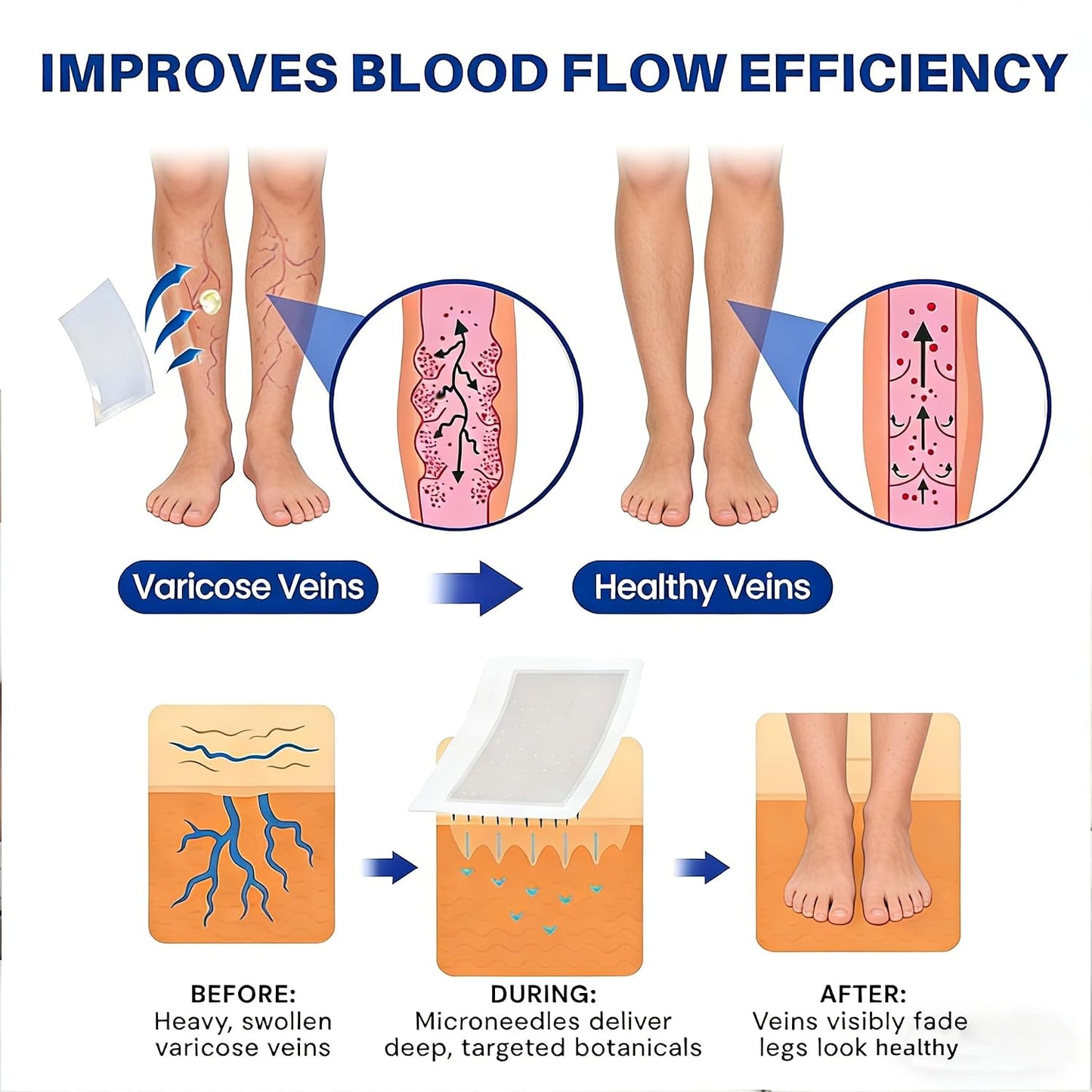 Instant Leg Relief: Micro-Dart Patches to End Throbbing Vein Pain