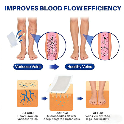 Instant Leg Relief: Micro-Dart Patches to End Throbbing Vein Pain