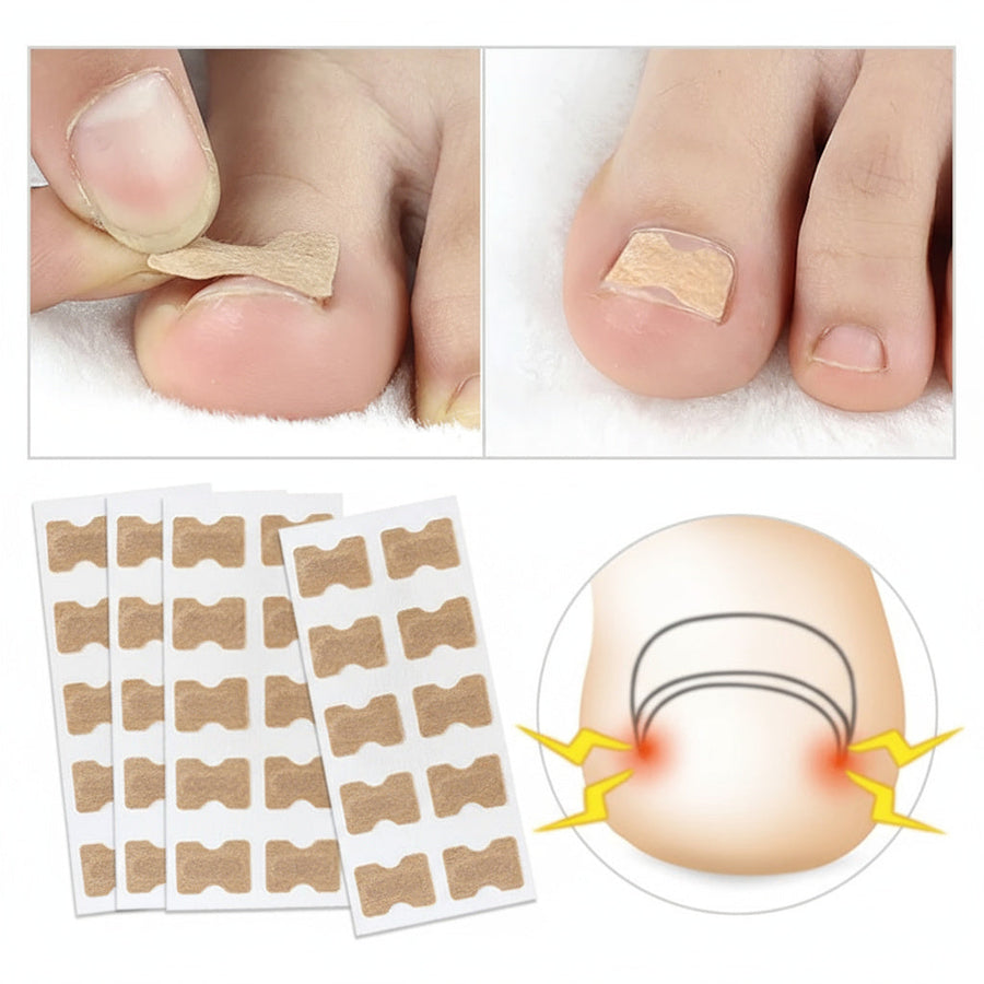 Instant Ingrown Toenail Relief: Professional Correction & Pain Recovery